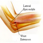 elbow-pain